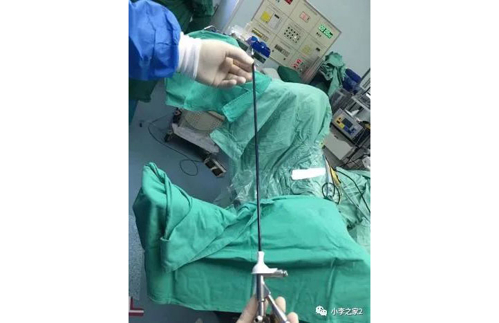 德國:軟鏡腎結(jié)石手術(shù)的預置支架效果要優(yōu)于輸尿管結(jié)石預置支架
